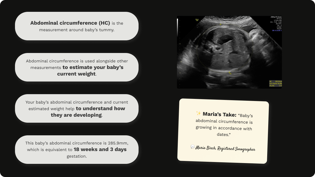 Explanation of abdominal circumference (AC), with an image of growth scan at 32 weeks gestation, and an assessment from Maria Birch.