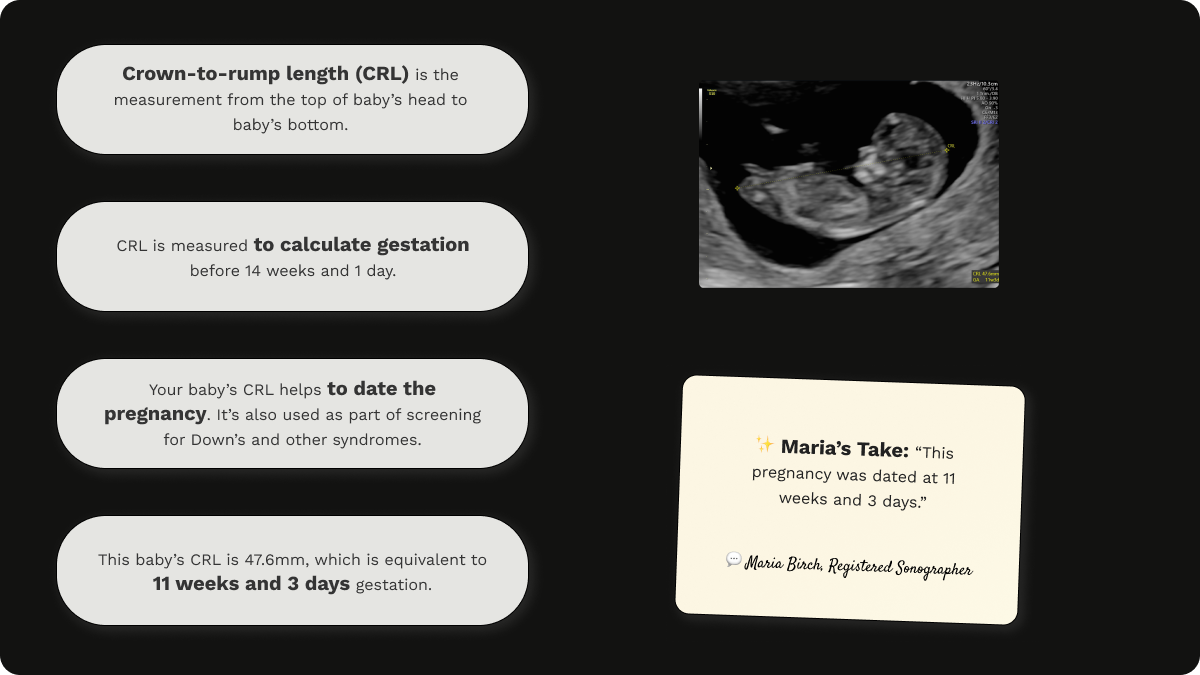 Explanation of crown-to-rump length (CRL) on an early pregnancy scan at 11 weeks gestation including an assessment by Maria Birch
