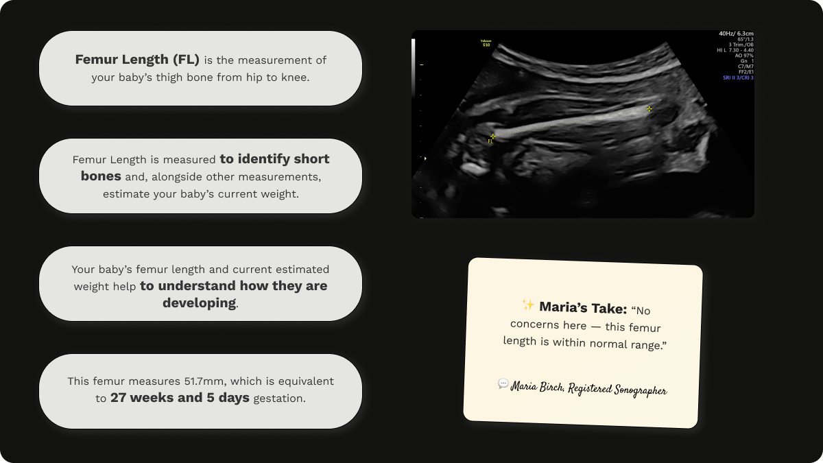 Explanation of femur length (FL), with an image of growth scan at 28 weeks gestation, and an assessment by Maria Birch.