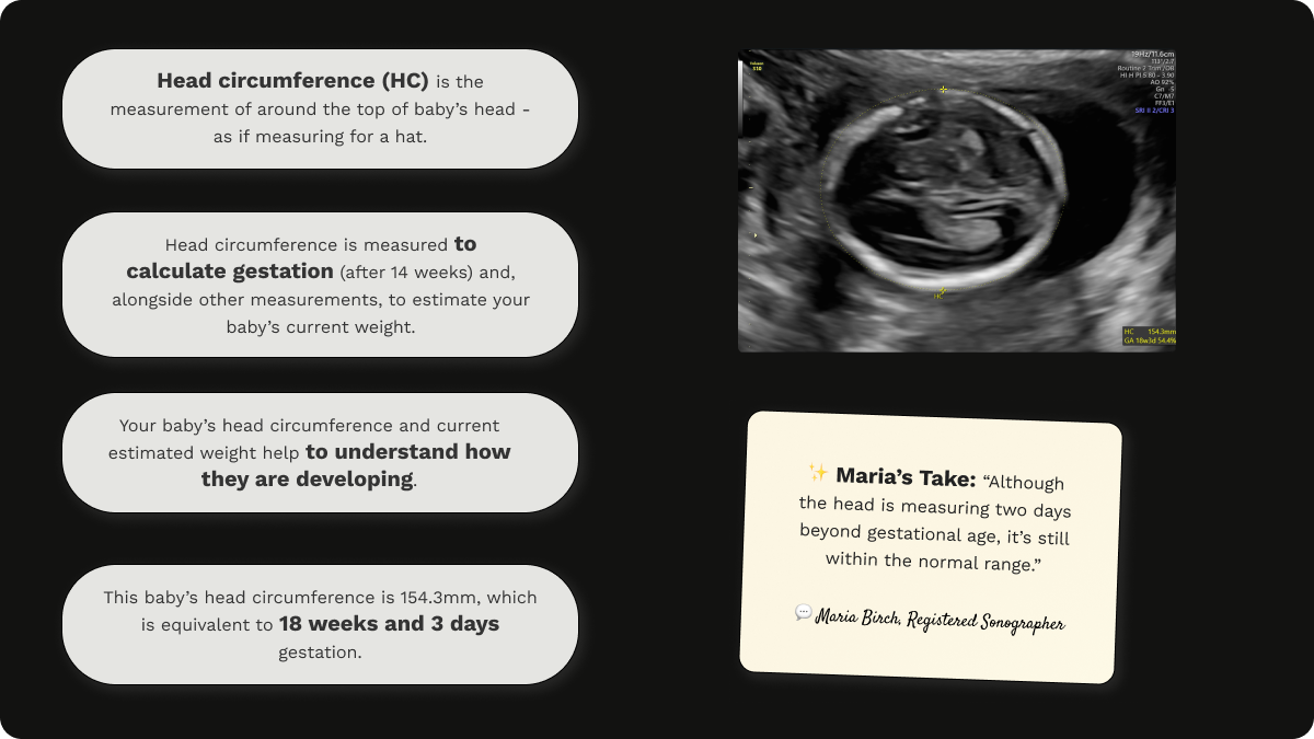 Explanation of head circumference (HC), with an image of a gender scan at 18 weeks gestation, and an assessment from Maria Birch.