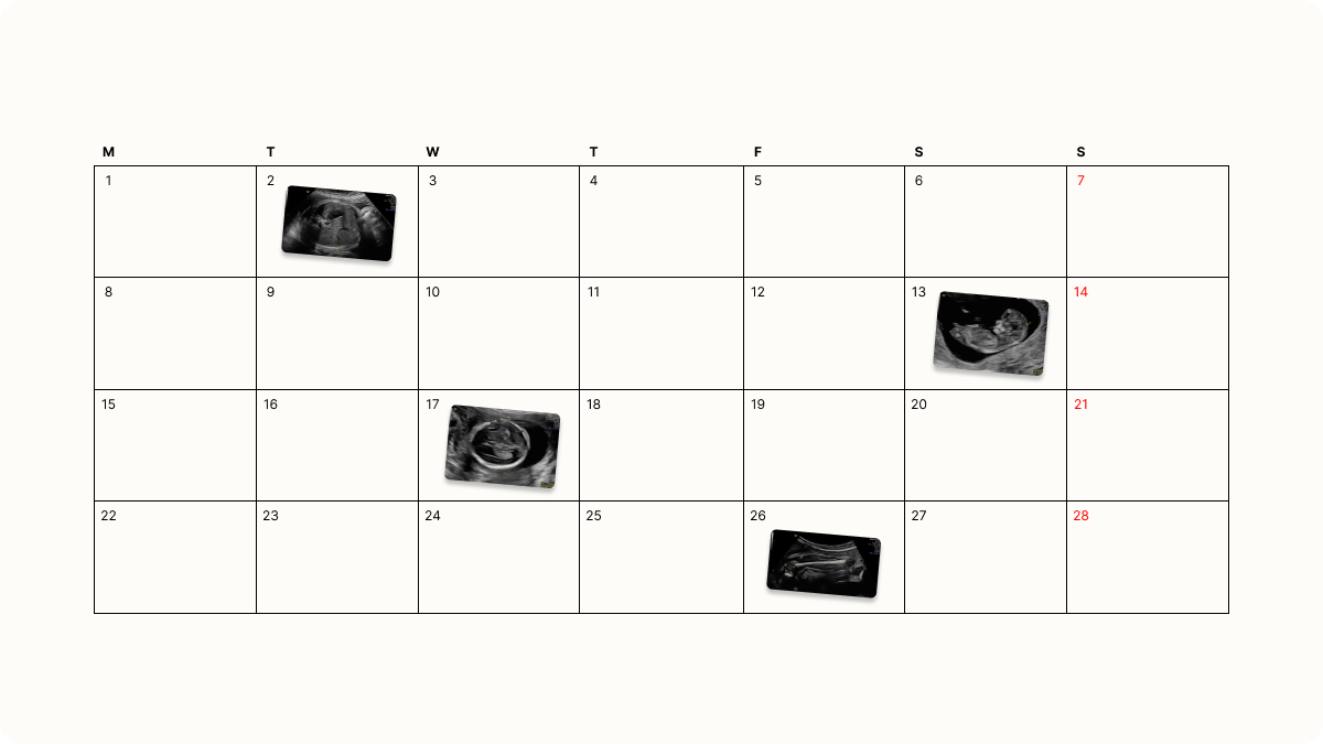 When to Get Each Pregnancy Scan: Timeline by Trimester
