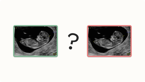 Is this normal? Two ultrasound images to contrast benign ultrasound findings with abnormal findings.