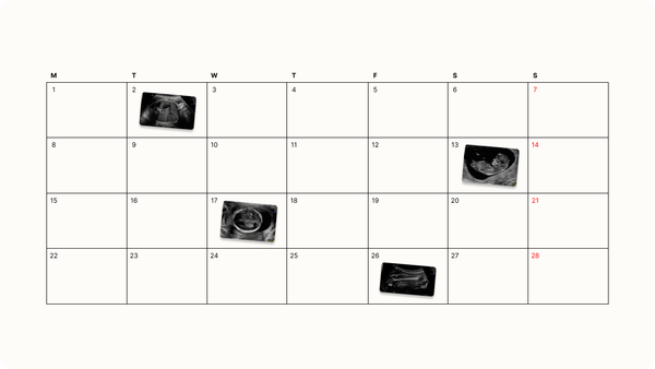 When to Get Each Pregnancy Scan: Timeline by Trimester